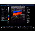 Scanner de ultra-som diagnóstico portátil novo da cor Doppler com software 3d 4d